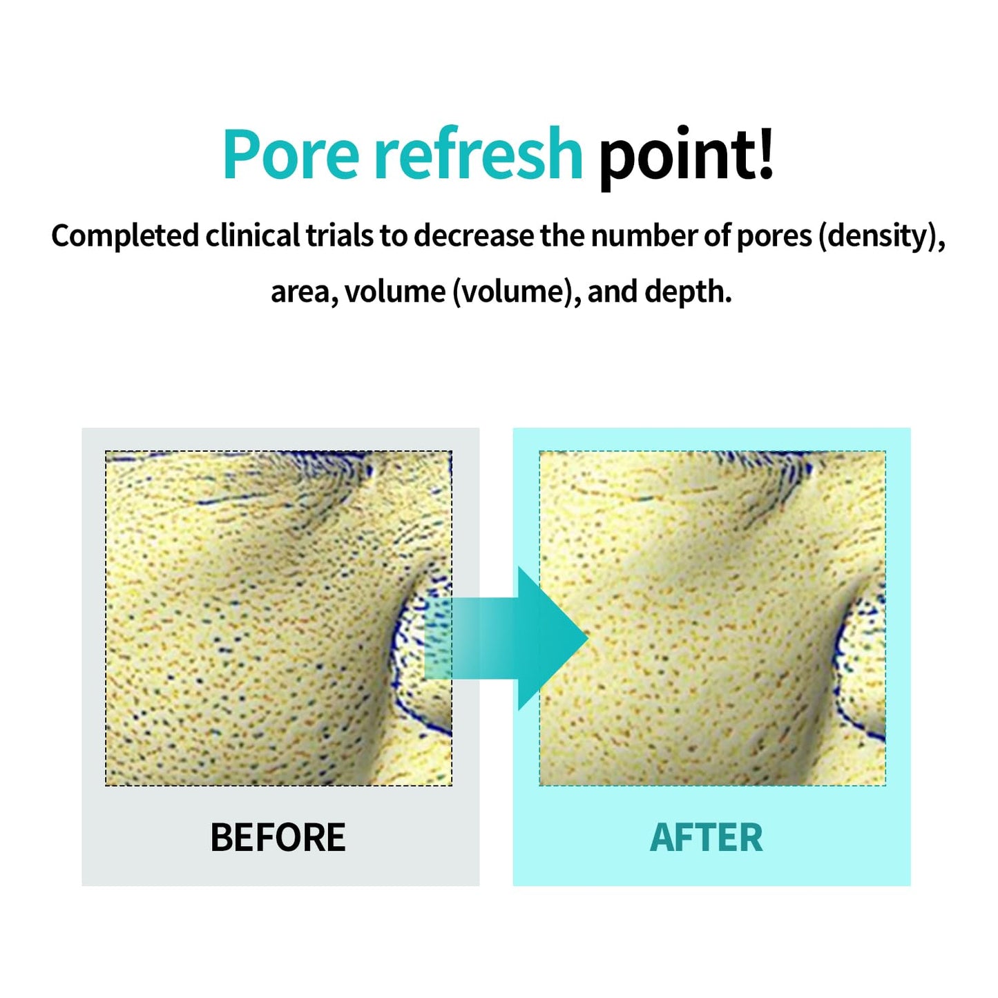 ILSO Serum Apretador de Poros Moringa 30 ml