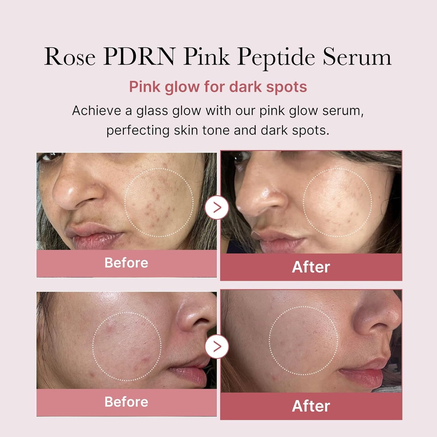 Suero PDRN Rosa Medicube | Glow coreano, Hidratación y Tono uniforme